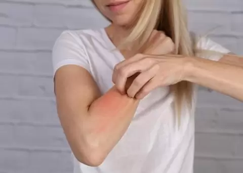 Inmunoterapia alergnica: combatiendo las alergias