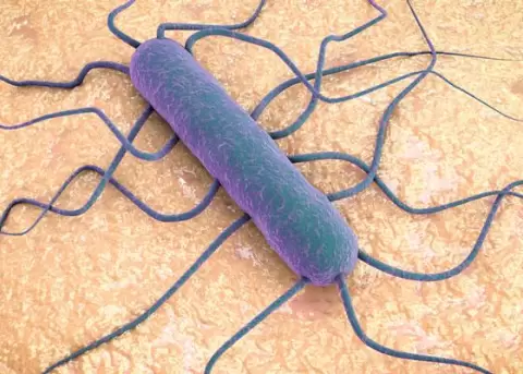 Se enciende una alerta sanitaria internacional  por brote de listeriosis en Espaa