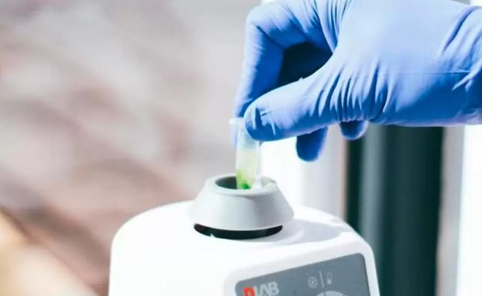 Ecuador ya tiene los reactivos para detectar casos de coronavirus