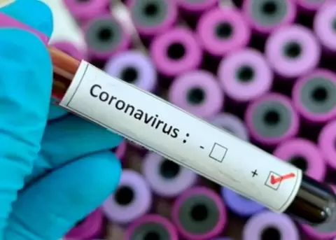 Ecuador descarta coronavirus en paciente chino en Quito y detecta hepatitis B