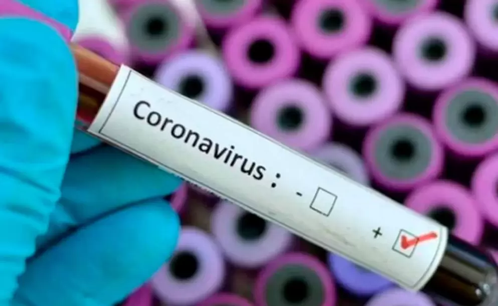 Lo que sabemos del nuevo coronavirus (Covid-19)