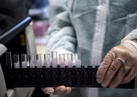 Tasa de casos positivos se ratifica por el d�ficit de test de covid-1