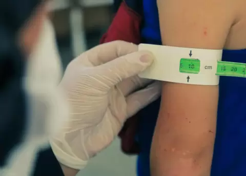 Desnutrici�n infantil en Ecuador: Quito con la tasa m�s alta