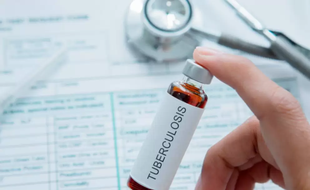 La tuberculosis super al COVID-19 como la mayor causa de muerte infecciosa en el mundo