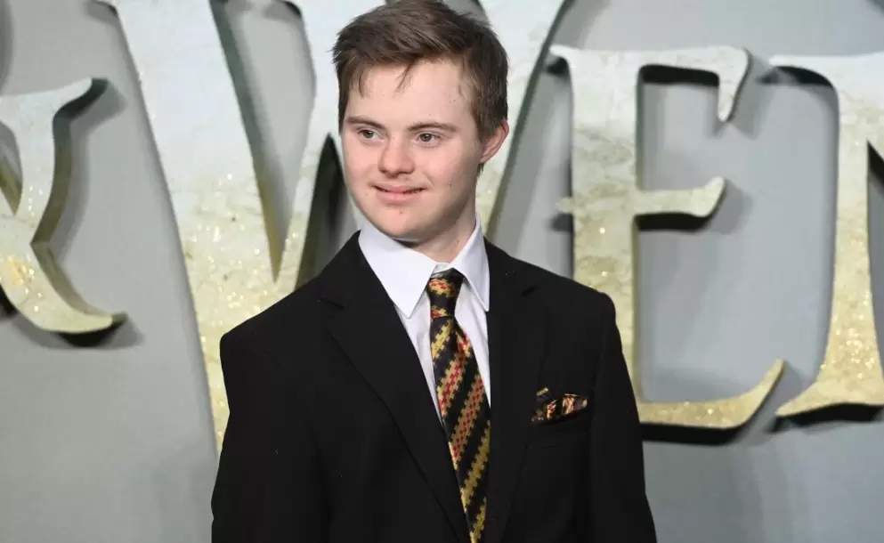 Por primera vez, un actor con sndrome de down tendr un papel protagnico en una pelcula de Disney