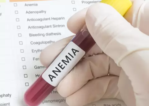 Anemia por deficiencia de hierro: Cules son los sntomas y las causas?