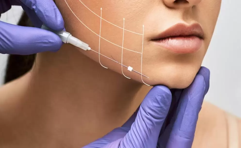 Procedimientos quirrgicos para definir el contorno facial