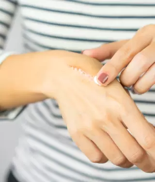 Proceso de cicatrizacin en la piel.