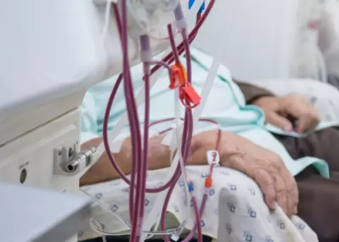 Paciente sometido a tratamientos de di�lisis.