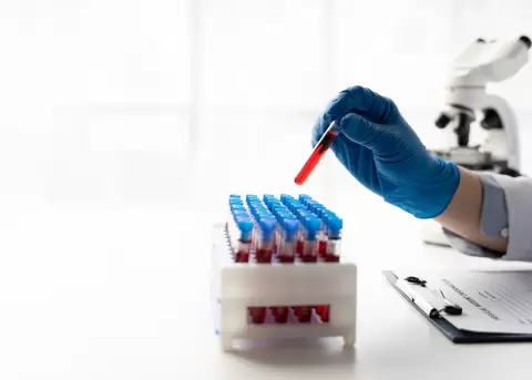 Sangre sint�tica japonesa: compatible con todos los grupos sangu�neos humanos.