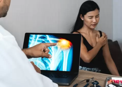 Las lesiones del manguito rotador son m�s comunes a partir de los 40 a�os.