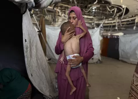 Un ni�o gazat� de 18 meses, de cuerpo esquel�tico, en brazos de su madre en una imagen del 26 de julio de 2025.