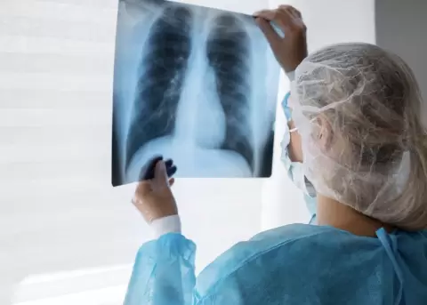 La neumon�a en Ecuador