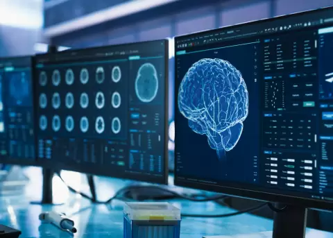 Nuevos estudios cient�ficos revelan que el cerebro se contin�a desarrollando hasta los 30 a�os.