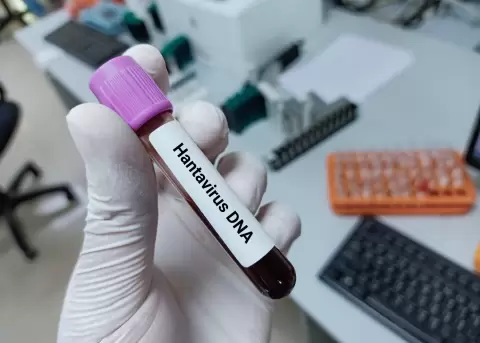 Hantavirus. �Se puede convertir en pandemia?.