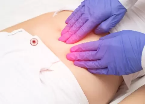 El s�ndrome de las varices p�lvicas afecta m�s a mujeres.