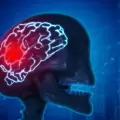 Un infarto cerebral puede destruir 2 millones de neuronas en solo 60 segundos