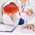 Cirug�a refractiva: nuevas opciones para corregir problemas de visi�n