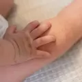 Lo que los padres deben saber sobre el virus manos, pies y boca
